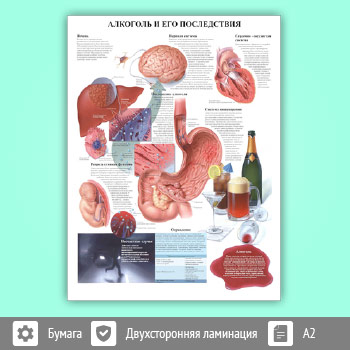 Плакат «Алкоголь и его последствия» (ЗОЖ-03, 1 лист, A2)